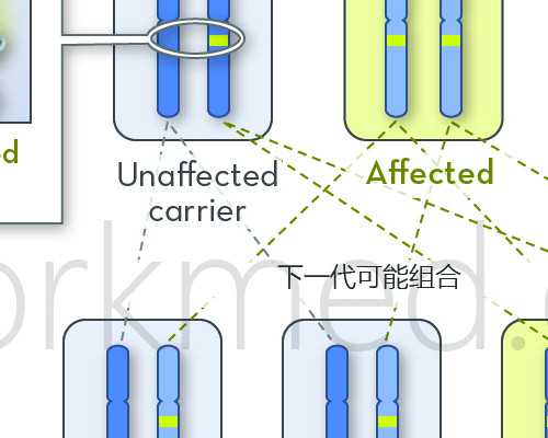 阴道炎：认识并防范其症状及其影响