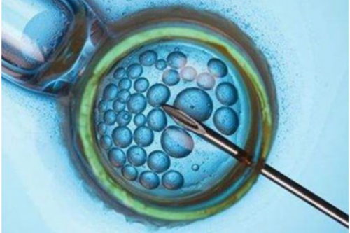 代孕的优缺点,曾经沧海也是爱（关于曾经沧海也是爱介绍）